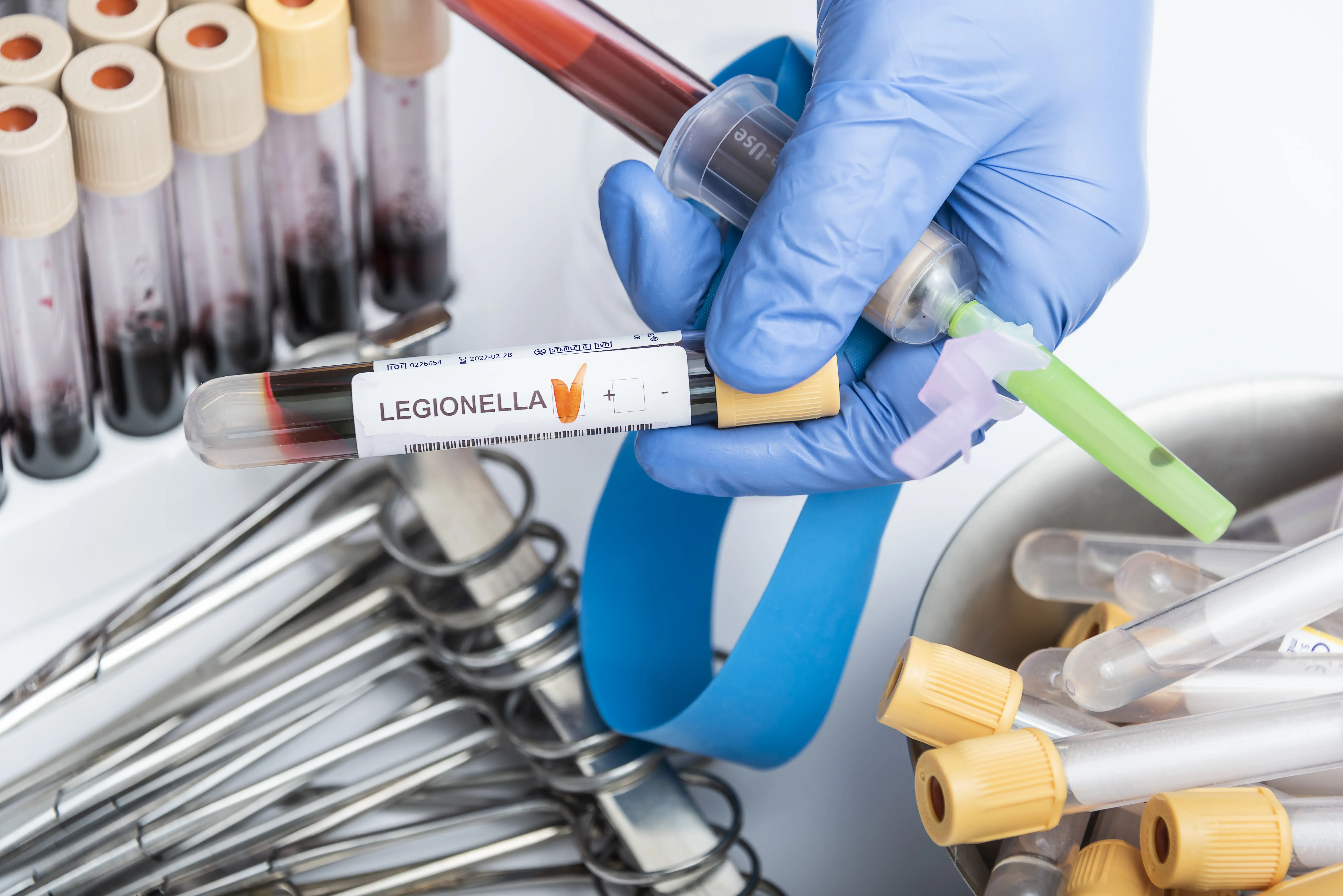 Legionnaires' Disease Signs: Causes, Symptoms, and When to Seek Help